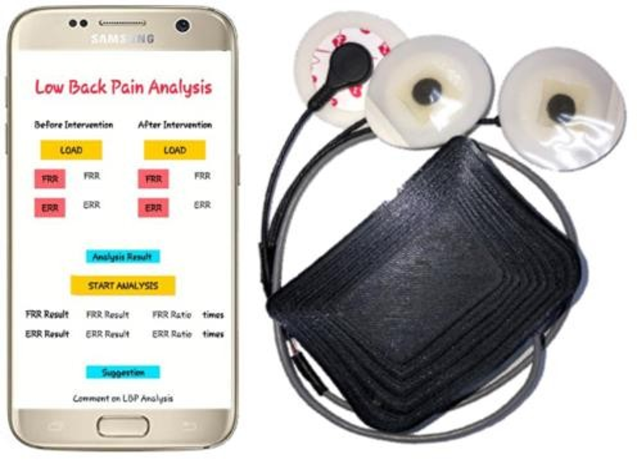 Smart Wearable EMG Device for Monitoring Lower Back Pain Rehabilitation